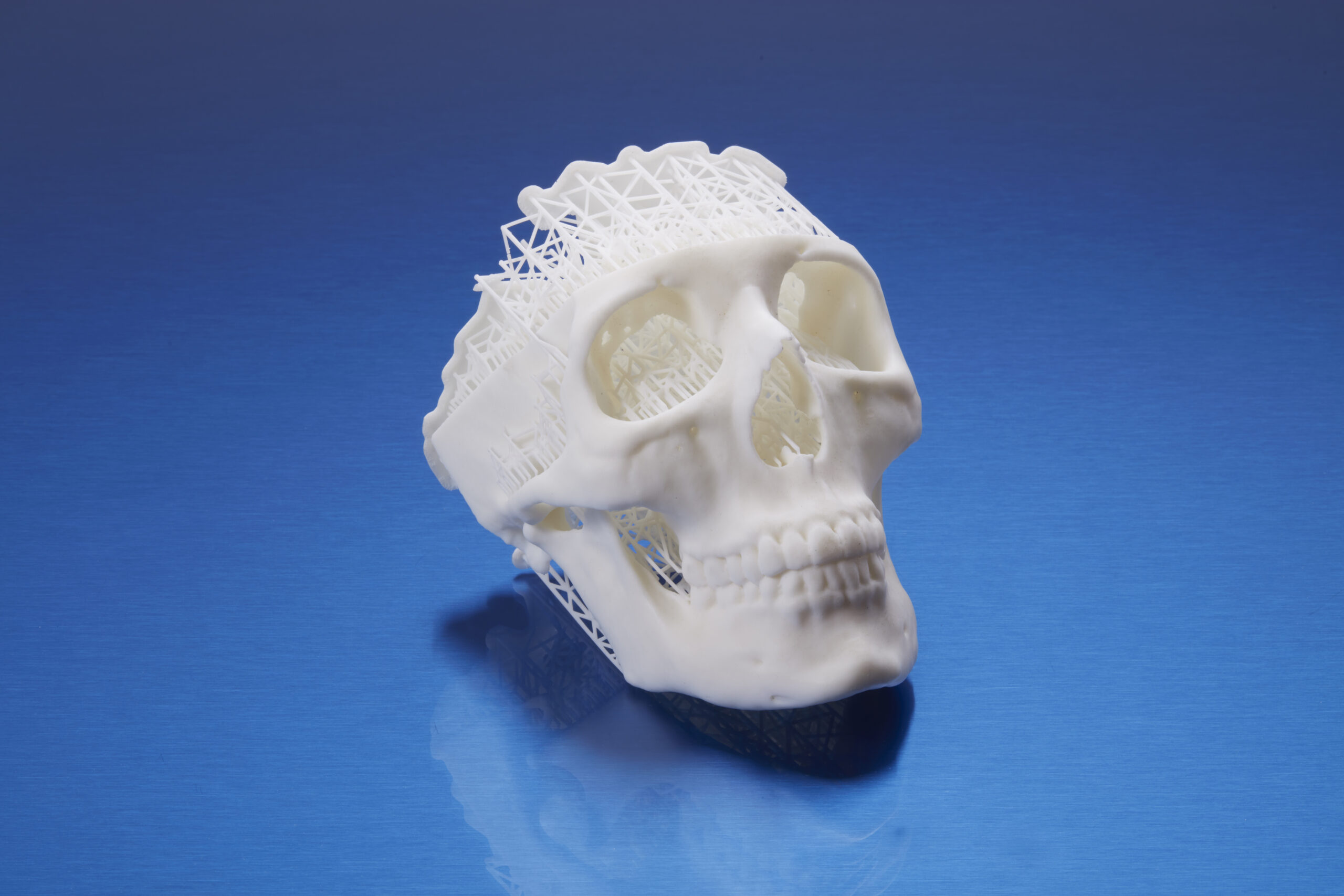 medical 3D printing Formlabs 3DHUBgr