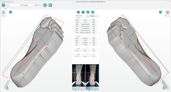 scanpod-usol-foot-3d-scanner-3DHUBgr