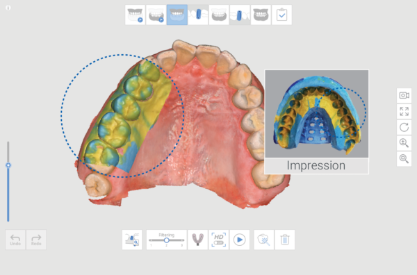 medit i600 intraoral 3d scanner 3DHUBgr